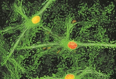 持续性疼痛会激活特殊脑细胞
